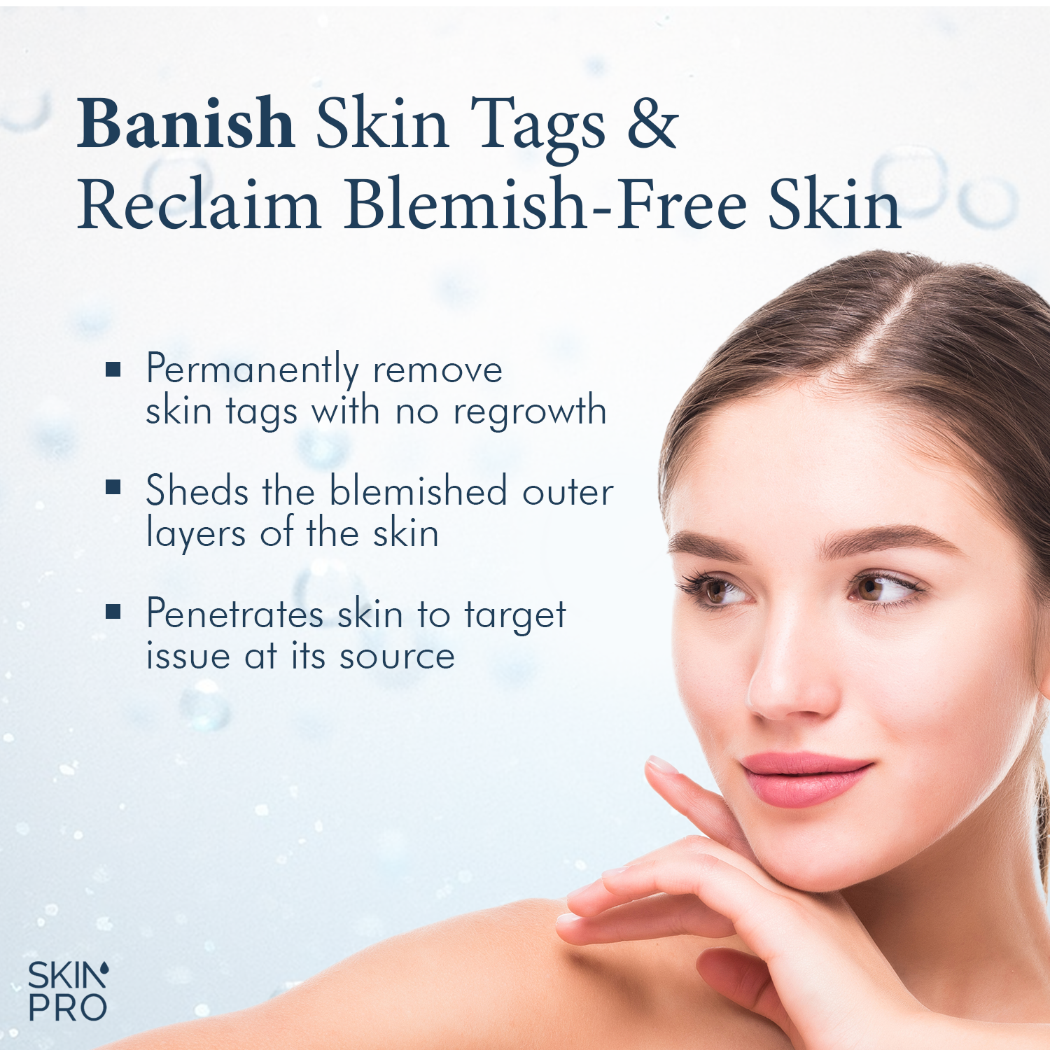 SkinPro Skin Tag Remover