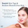 SkinPro Skin Tag Remover