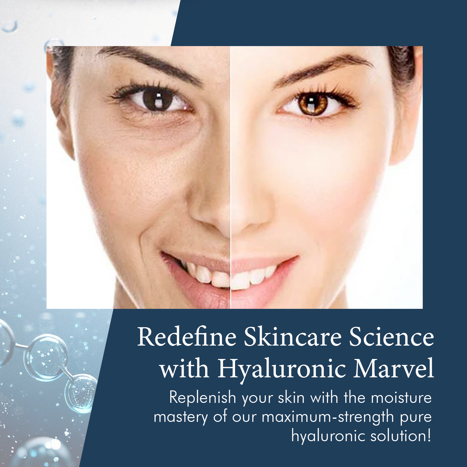 Delfogo Rx 100% Pure Hyaluronic Acid Cream