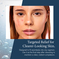 SkinPro 911 Blemish Treatment