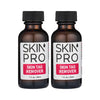SkinPro Skin Tag Remover