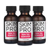 SkinPro Skin Tag Remover