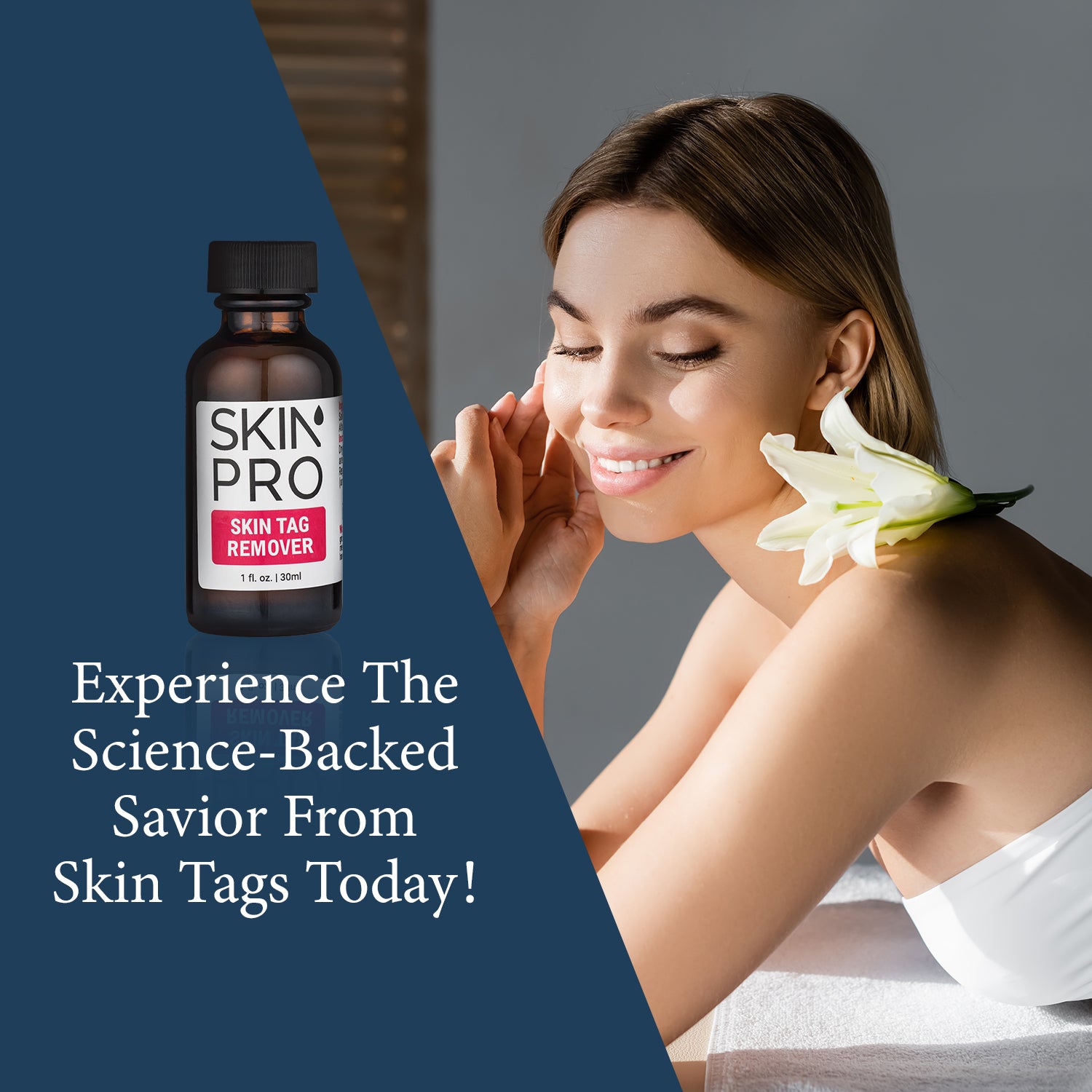SkinPro Skin Tag Remover